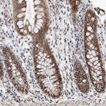SNRNP200 Antibody in Immunohistochemistry (Paraffin) (IHC (P))