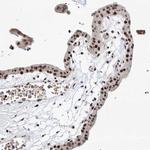 SNRNP200 Antibody in Immunohistochemistry (Paraffin) (IHC (P))