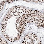 SNRNP200 Antibody in Immunohistochemistry (Paraffin) (IHC (P))