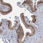 ZNF426 Antibody in Immunohistochemistry (IHC)