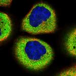 SMG7 Polyclonal Antibody