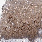 SMG7 Antibody in Immunohistochemistry (Paraffin) (IHC (P))