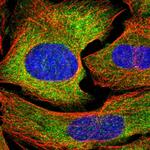 GAPVD1 Polyclonal Antibody