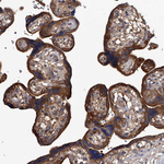 GAPVD1 Antibody in Immunohistochemistry (Paraffin) (IHC (P))