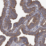 GAPVD1 Antibody in Immunohistochemistry (Paraffin) (IHC (P))