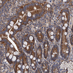 GAPVD1 Antibody in Immunohistochemistry (Paraffin) (IHC (P))