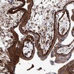 GAPVD1 Antibody in Immunohistochemistry (IHC)