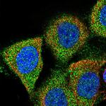 GAPVD1 Polyclonal Antibody