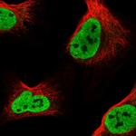 GLTSCR1L Polyclonal Antibody