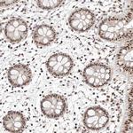GLTSCR1L Antibody in Immunohistochemistry (Paraffin) (IHC (P))