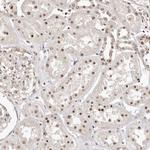 GLTSCR1L Antibody in Immunohistochemistry (Paraffin) (IHC (P))
