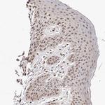 GLTSCR1L Antibody in Immunohistochemistry (Paraffin) (IHC (P))