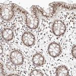 GLTSCR1L Antibody in Immunohistochemistry (IHC)