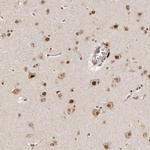 GLTSCR1L Antibody in Immunohistochemistry (IHC)