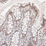 GLTSCR1L Antibody in Immunohistochemistry (IHC)