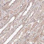 GLTSCR1L Antibody in Immunohistochemistry (IHC)
