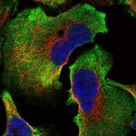 SPATC1L Polyclonal Antibody