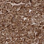 APLF Polyclonal Antibody