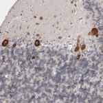FAM167B Antibody in Immunohistochemistry (Paraffin) (IHC (P))