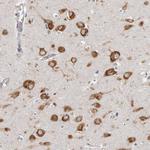 FAM167B Antibody in Immunohistochemistry (Paraffin) (IHC (P))