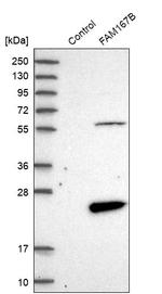 FAM167B Antibody in Western Blot (WB)