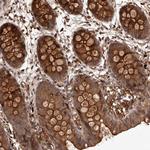 CRYZL1 Polyclonal Antibody