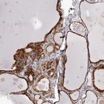 PIGX Antibody in Immunohistochemistry (Paraffin) (IHC (P))