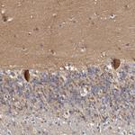 FAM189A2 Polyclonal Antibody