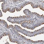 FAM189A2 Antibody in Immunohistochemistry (Paraffin) (IHC (P))