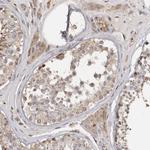 FAM189A2 Antibody in Immunohistochemistry (Paraffin) (IHC (P))