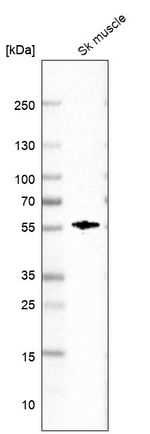 FAM189A2 Antibody in Western Blot (WB)