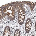 DHPS Antibody in Immunohistochemistry (Paraffin) (IHC (P))
