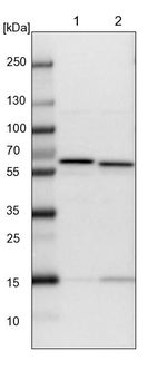 TCP-1 theta Antibody in Western Blot (WB)