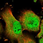 TMUB1 Polyclonal Antibody