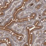 TMUB1 Antibody in Immunohistochemistry (Paraffin) (IHC (P))