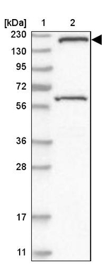 SMC4 Antibody in Western Blot (WB)