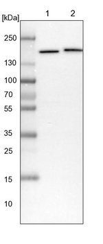 SMC4 Antibody in Western Blot (WB)