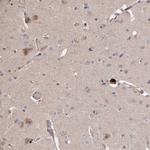 BAAT1 Antibody in Immunohistochemistry (Paraffin) (IHC (P))