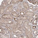 BAAT1 Antibody in Immunohistochemistry (Paraffin) (IHC (P))