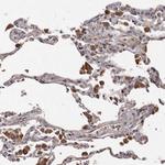 BAAT1 Antibody in Immunohistochemistry (Paraffin) (IHC (P))