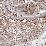 BAAT1 Polyclonal Antibody