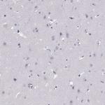 PRPH2 Antibody in Immunohistochemistry (Paraffin) (IHC (P))