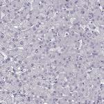 PRPH2 Antibody in Immunohistochemistry (Paraffin) (IHC (P))