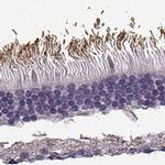 PRPH2 Antibody in Immunohistochemistry (IHC)