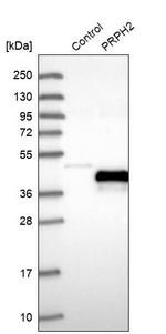 PRPH2 Antibody in Western Blot (WB)