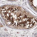 C7orf43 Antibody in Immunohistochemistry (Paraffin) (IHC (P))