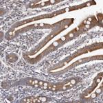 C7orf43 Polyclonal Antibody