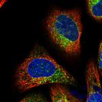 TMC7 Polyclonal Antibody