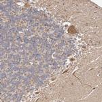 LCHN Polyclonal Antibody