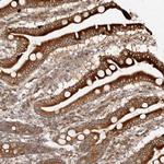 LCHN Antibody in Immunohistochemistry (Paraffin) (IHC (P))